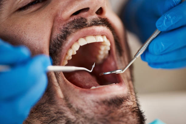Best Pediatric Emergency Dentist in West Miami, FL